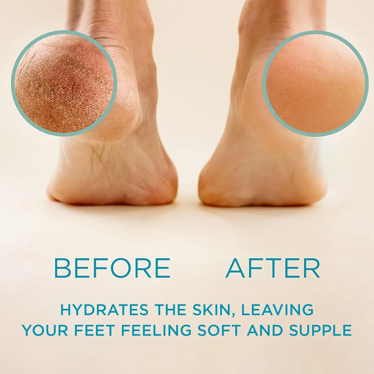 Callus Remover for Feet - Original, Powerful Formulation - Extra Strength Gel, Home Pedicure Foot Spa Results - Cracked & Dead Dry Skin Supplies - 8 Oz